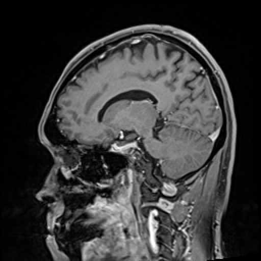 Click on the Serie image to view the images of VILLANUEVA, WILLIAM A.